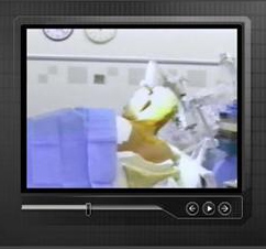 sbimount head mount used at SBI to allow robot arm to kill kuato